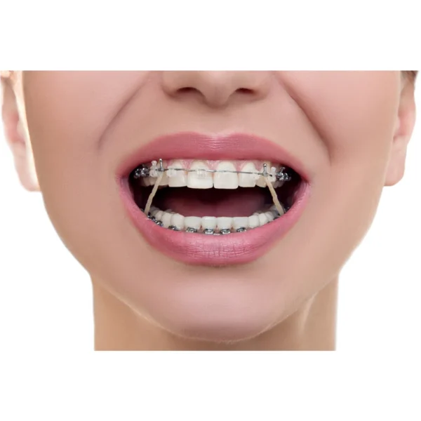 TP Ortho Plain Latex Tooth Colour Elastics Tan 5/16" - 4.5 Oz (Short Expiry 10-2025)
